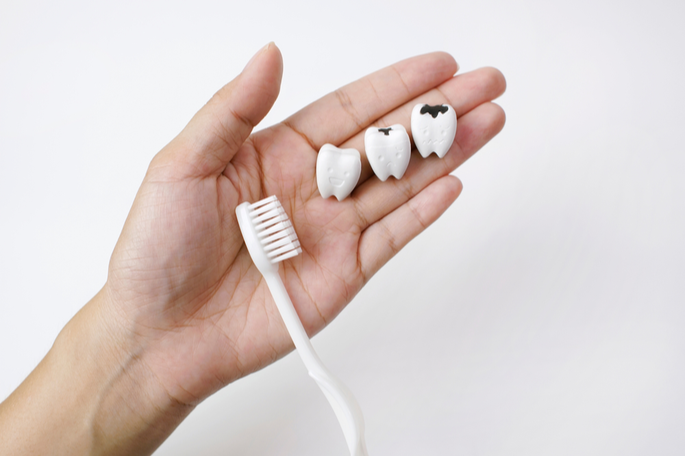 Why Do I Have Cavities When I Brush Regularly? | Dental Remedies