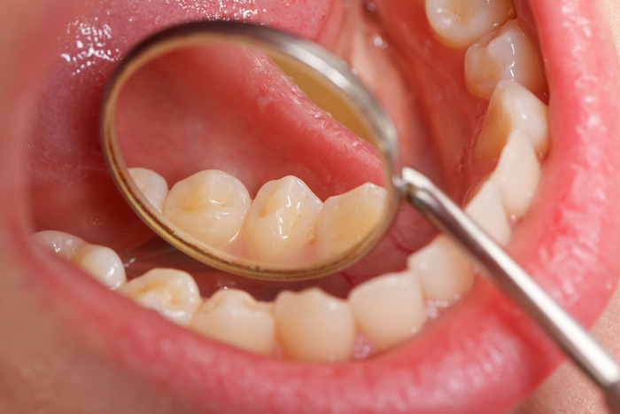 OPTIONS FOR COMPREHENSIVE DENTAL CARE IN ST. AUGUSTINE | Dental Remedies