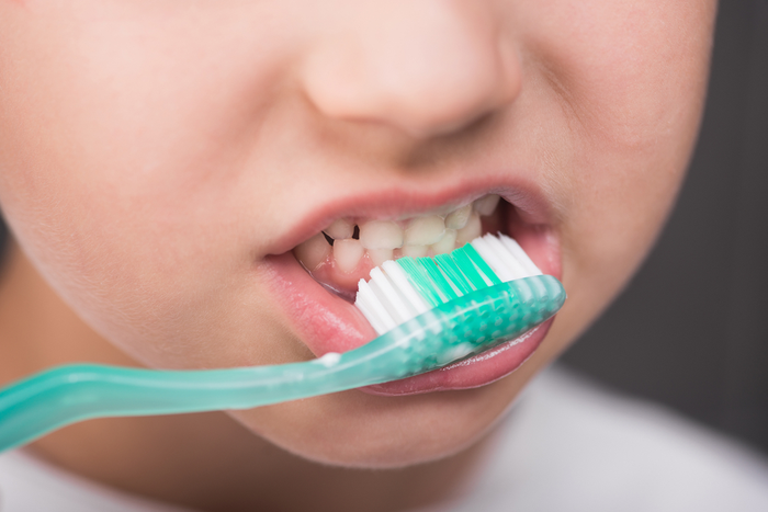 Tips on Protecting Your Childs Teeth _ Dental Remedies