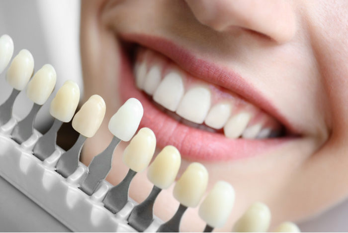 WHAT ARE THE BEST COSMETIC DENTISTRY PROCEDURES?
