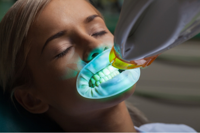 IS IN-OFFICE TEETH WHITENING EFFECTIVE IF MY TEETH ARE YELLOW?