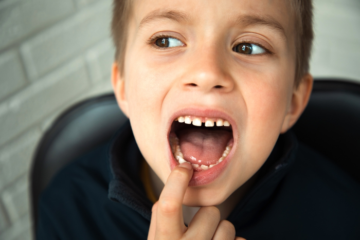 Who Is The Best Children's Dentist in St. Augustine FL?
