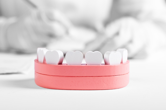 What Are The Benefits of Dentures?
