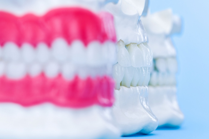 Reconstructive Dentistry for Damaged Teeth
