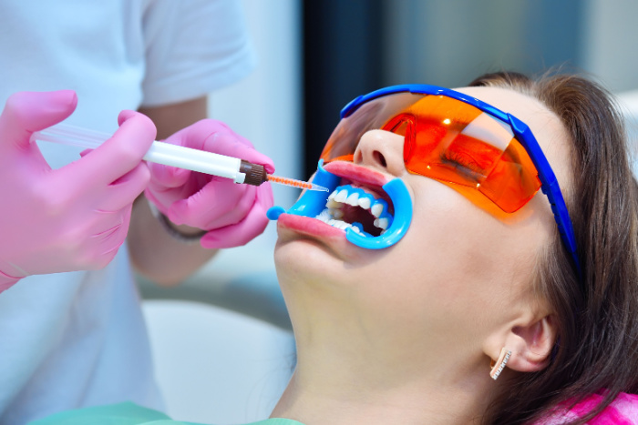 Top Dentist for Teeth Whitening Solutions in St. Augustine